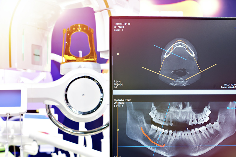 Digital X-Rays in Newark